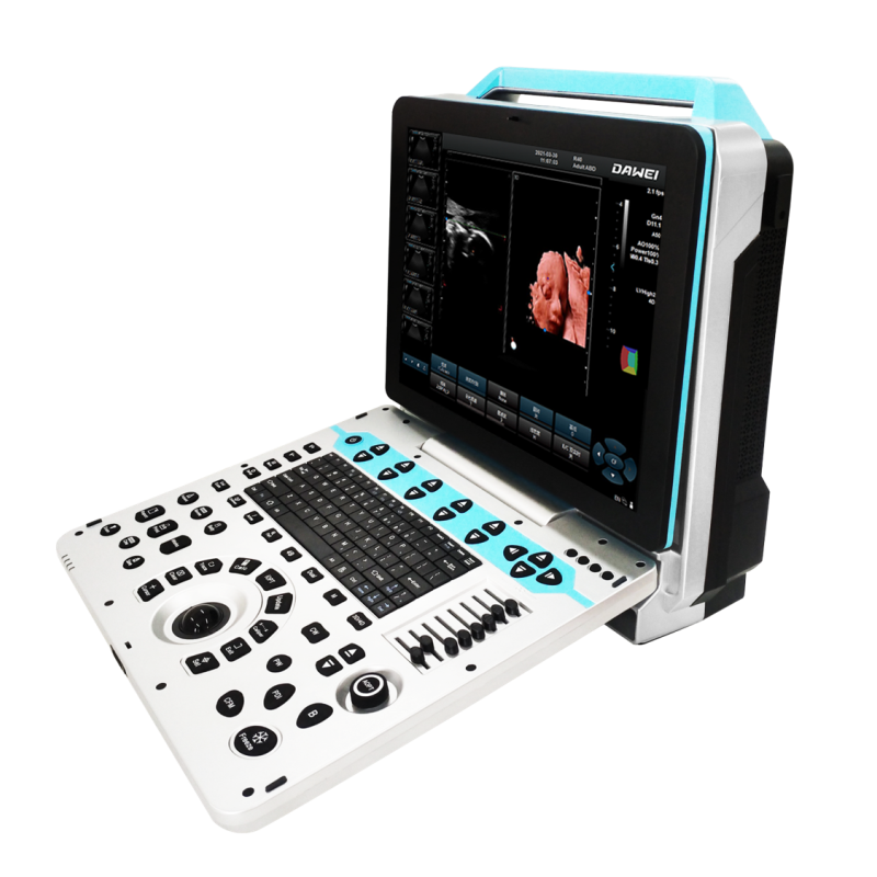 Ecógrafo Doppler Color DW-P5 | Ecografías 3D 4D